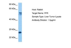 VPS51 Rabbit anti-Human, Polyclonal, Novus Biologicals 0.1ml; Unconjugated:Antibodies,